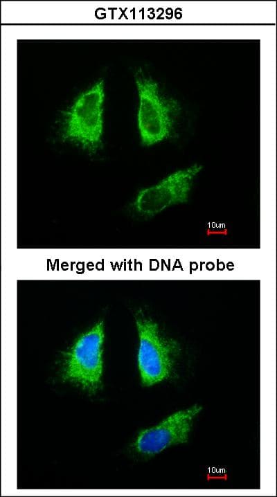 IHC-plus™ Polyclonal Rabbit anti-Human YWHAB / 14-3-3 Beta Antibody (IHC, IF, WB)