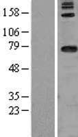 DARS2 Protein (Over-Expression Lysate Myc-DDK (Flag))