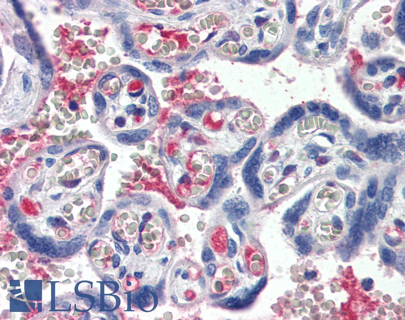 IHC-plus™ Polyclonal Goat anti-Human Complement C1s Antibody (IHC)