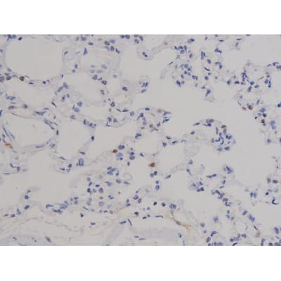STAT6 Antibody (phospho-Thr645)
