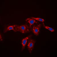 Polyclonal Rabbit anti-Human CASP7 / Caspase 7 Antibody (Internal, IF, WB)