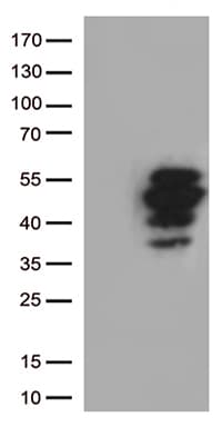FCER2 / CD23 Antibody (aa48-321, clone UMAB101)