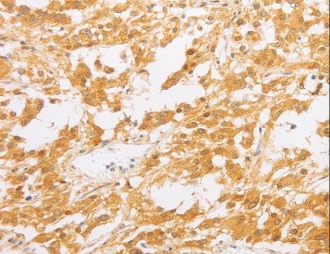 Polyclonal Rabbit anti-Human PDE4D Antibody (IHC, WB)