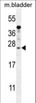 Polyclonal Rabbit anti-Human KIAA1644 Antibody (aa18-46, IHC, WB)