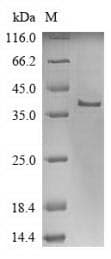 Human PERP Protein (Recombinant 10His-SUMO, N-terminus + Myc, C-terminus)
