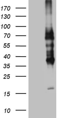 CD30 Antibody (aa408-595, clone OTI2H2)