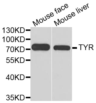 Tyrosinase Antibody