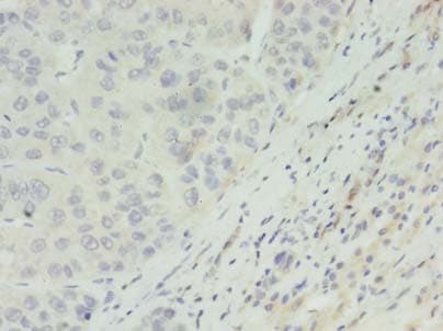 IHC-plus™ ACADL Antibody