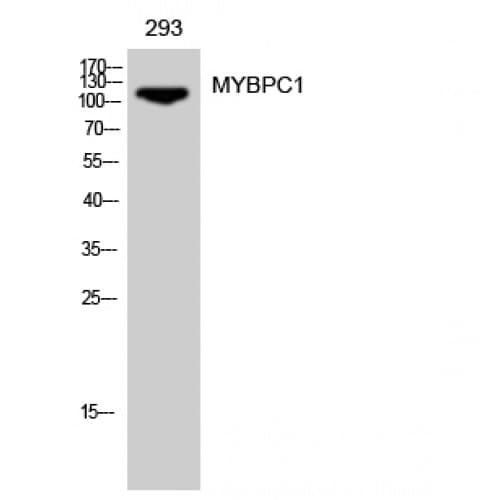 MYBPC1 Antibody (190-270 aa, Internal)