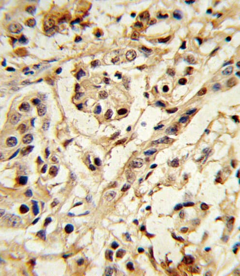 Polyclonal Rabbit anti-Human BMI1 / PCGF4 Antibody (IHC, IF, WB)