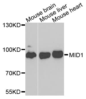 MID1 Antibody