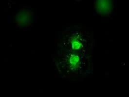 MAP2K4 / MKK4 Antibody (clone OTI4B4)