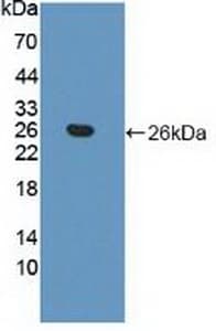 APOB / Apolipoprotein B Antibody (aa3365-3548)