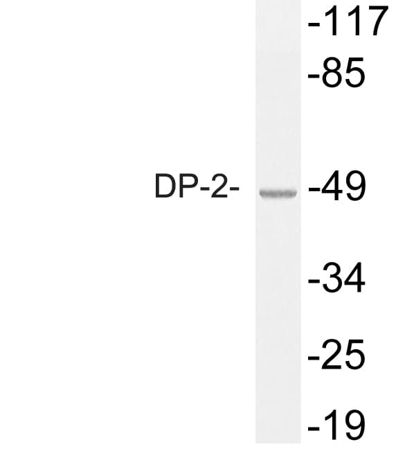 TFDP2 / DP2 Antibody (aa64-113)