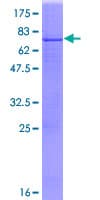 Human LECT1 / Chondromodulin-I Protein (Recombinant GST)