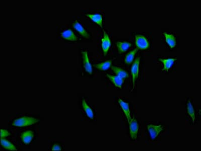 Polyclonal Rabbit anti-Human DGAT2 Antibody (IHC, IF, WB)