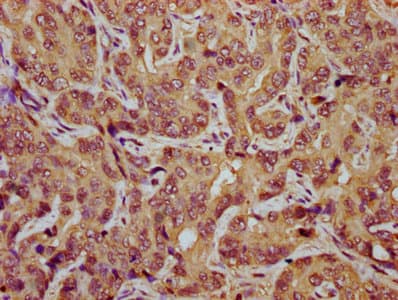 TES / Testin Antibody (aa130-260)