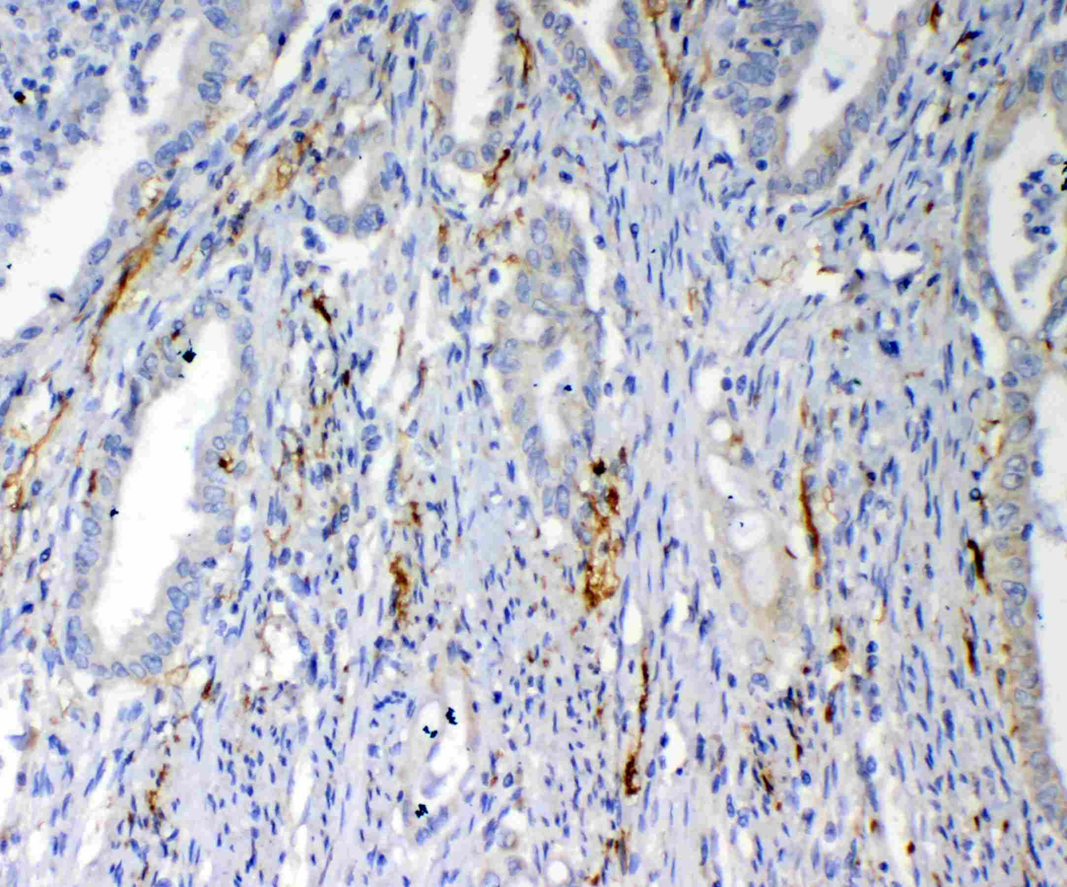 VEGFD Antibody (aa89-205)