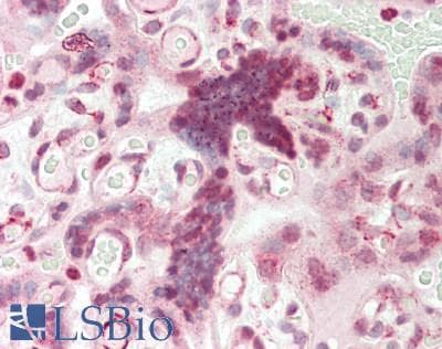 IHC-plus™ FANCA Antibody (N-Terminal)