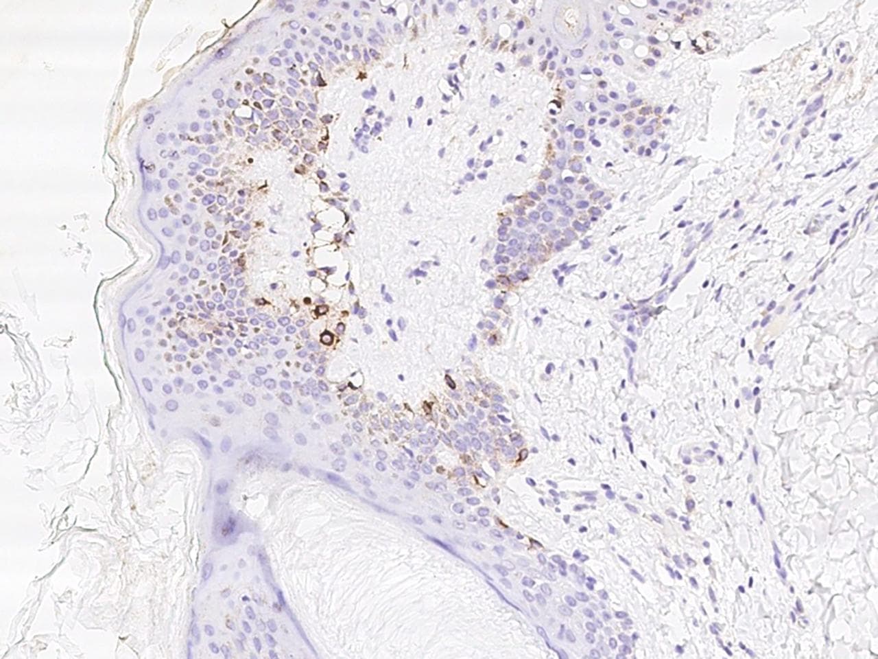 RANBP2 / TRP1 Antibody