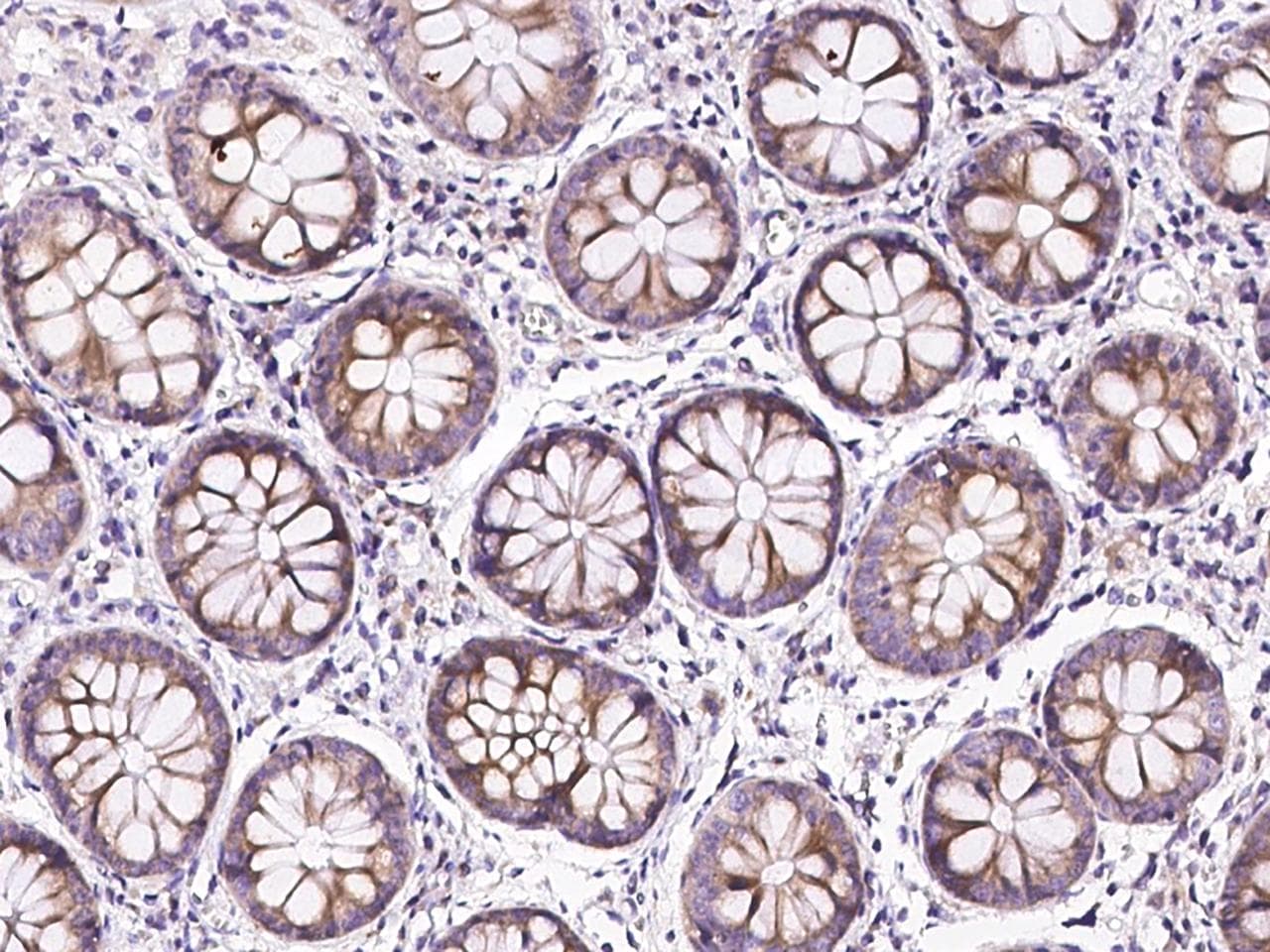 Polyclonal Rabbit anti-Human TLR3 Antibody (Preservative Free, IHC, IF)