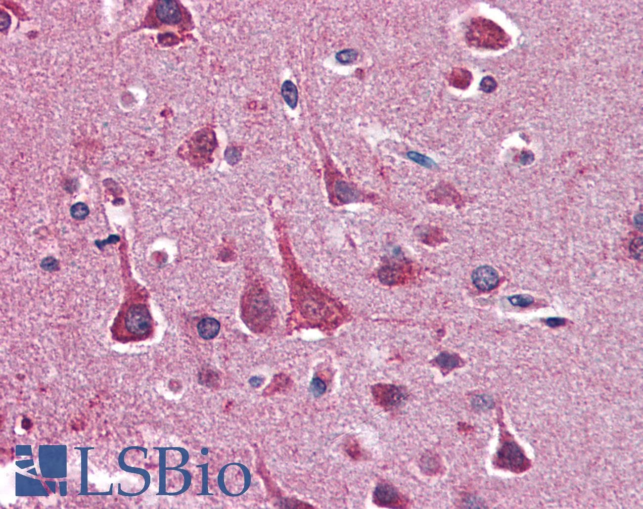 IHC-plus™ YWHAQ / 14-3-3 Theta Antibody (aa1-245, clone AT1A1)