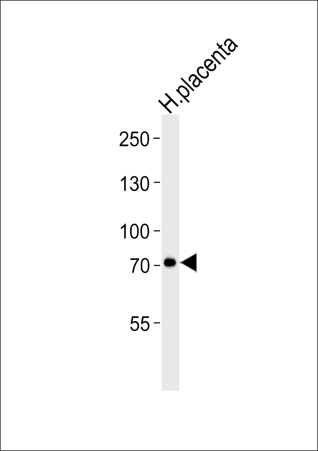 CAPN6 / Calpain 6 Antibody (clone 1395CT446.22.5)