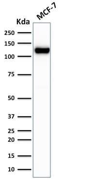 PathPlus™ CDH1 / E Cadherin Antibody (clone rCDH1/1525)