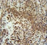 ZNF667 / MIPU1 Antibody (aa303-331)