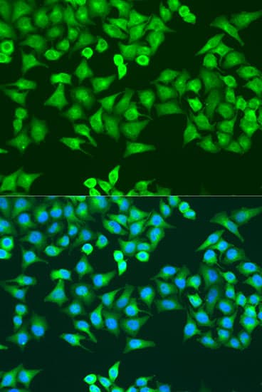 R1 / RRM1 Antibody