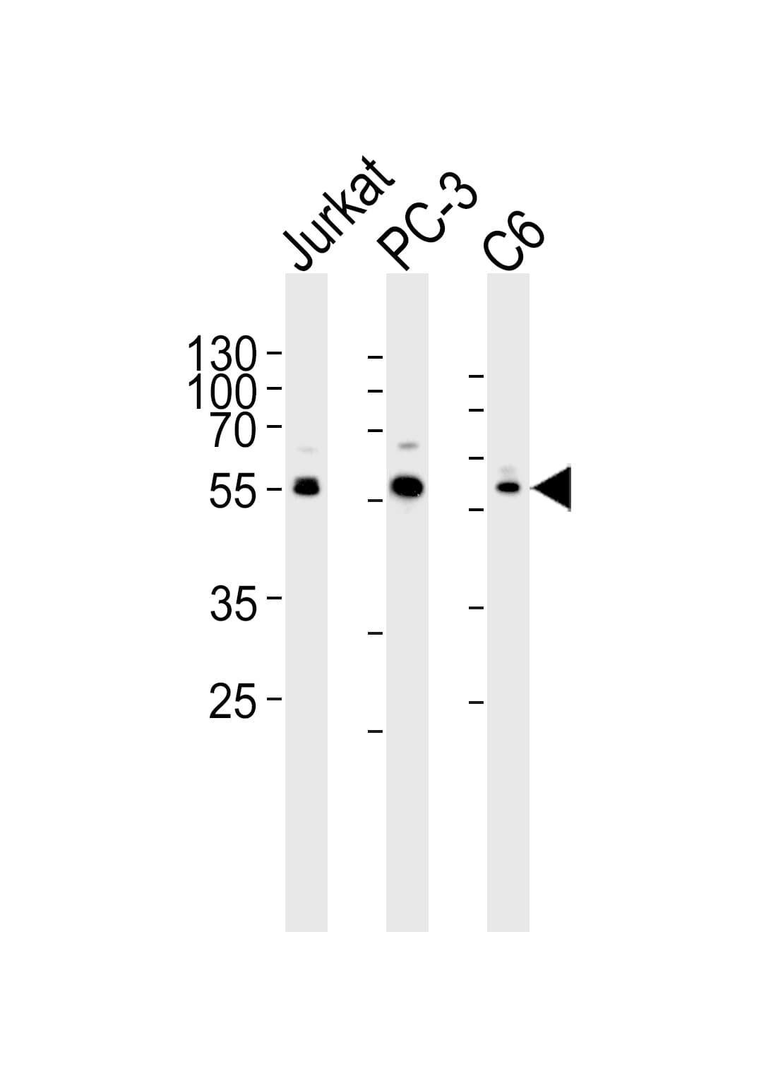 AKT1 Antibody (aa278-312)
