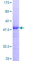 Human RGS20 / RGSZ1 Protein (Recombinant GST)