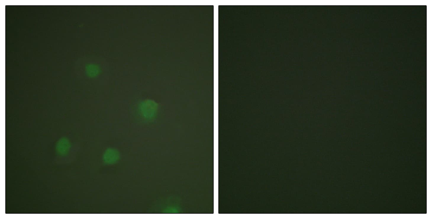 IHC-plus™ PR / Progesterone Receptor Antibody (aa371-420)