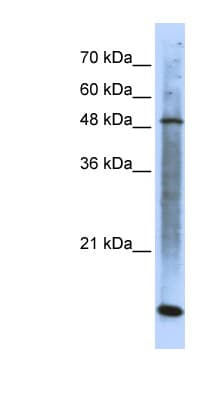 SMARCE1 / BAF57 Antibody (aa39-88)