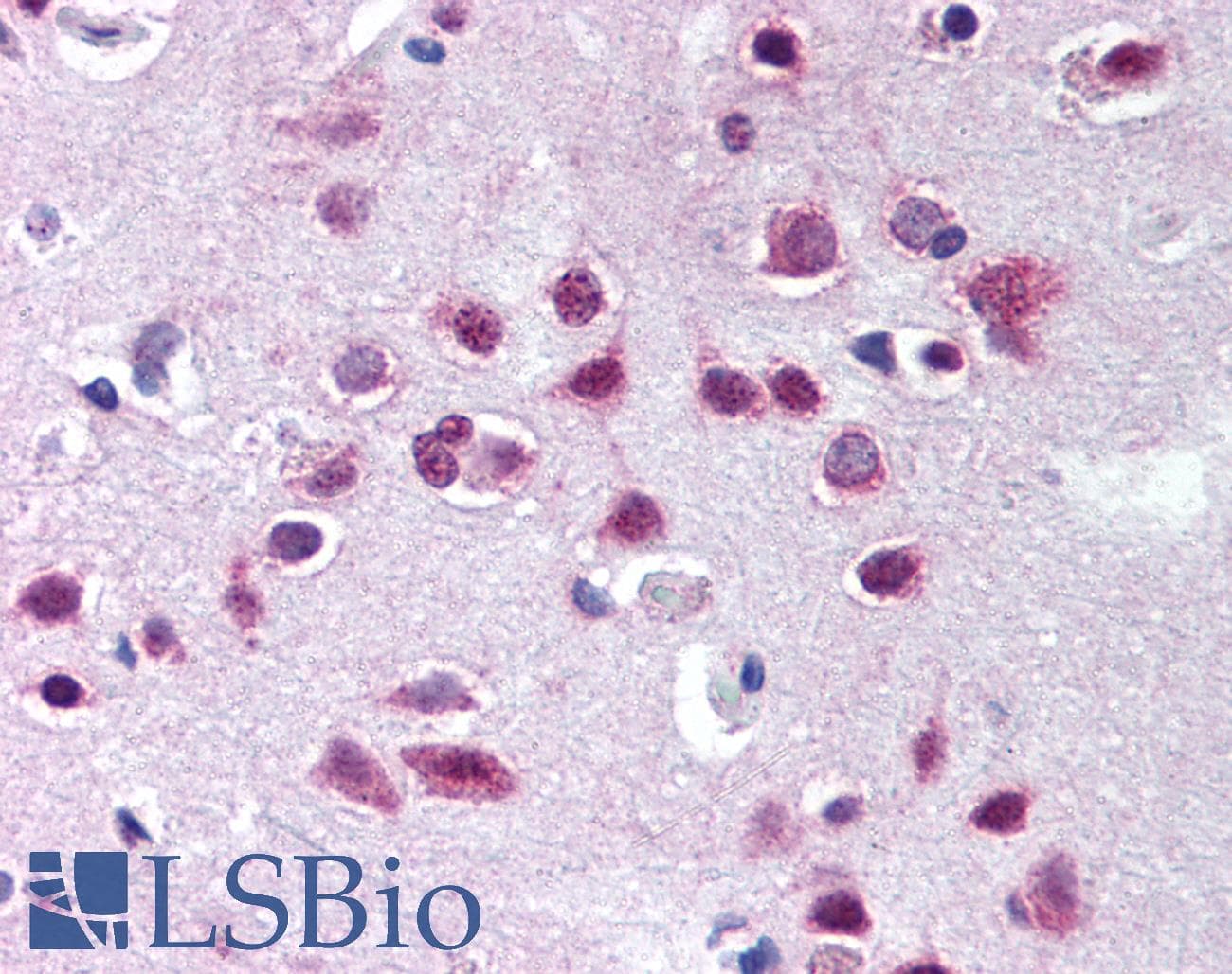 IHC-plus™ Polyclonal Rabbit anti-Human UBE1L2 / UBE1L2 Antibody (aa300-350, IHC, WB)