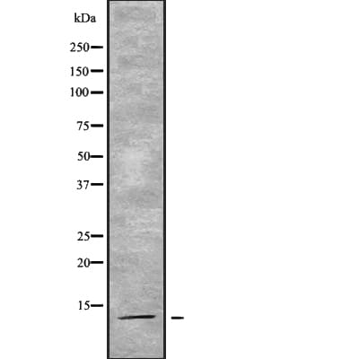 ACYP2 Antibody