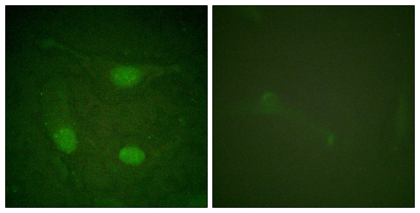 ELK3 / NET Antibody (phospho-Ser357)