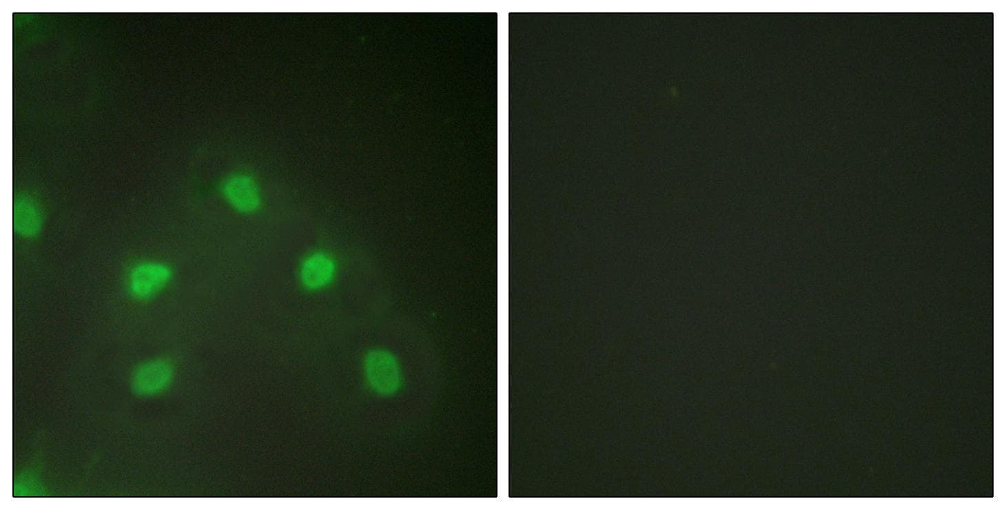 Polyclonal Rabbit anti-Human HNRNPL / hnRNP L Antibody (IHC, IF, WB)