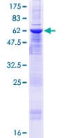 Human ZMYND12 Protein (Recombinant GST)