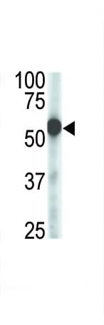 ZMPSTE24 Antibody (aa400-430)