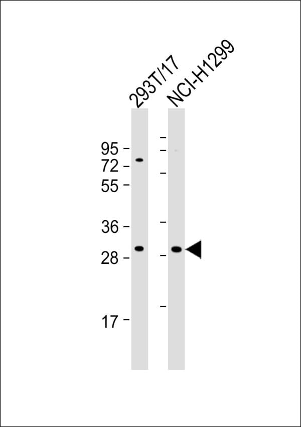 Polyclonal Rabbit anti-Human ECI1 / DCI Antibody (WB)