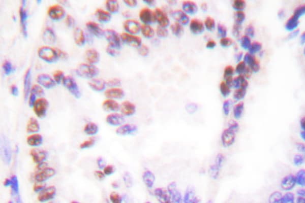 HDAC9 Antibody (Pro1047)