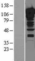 ZNF148 / ZBP-89 Protein (Over-Expression Lysate Myc-DDK (Flag))