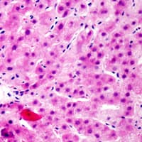 Polyclonal Rabbit anti-Human FRS2 Antibody (C-Terminus, IHC, WB)