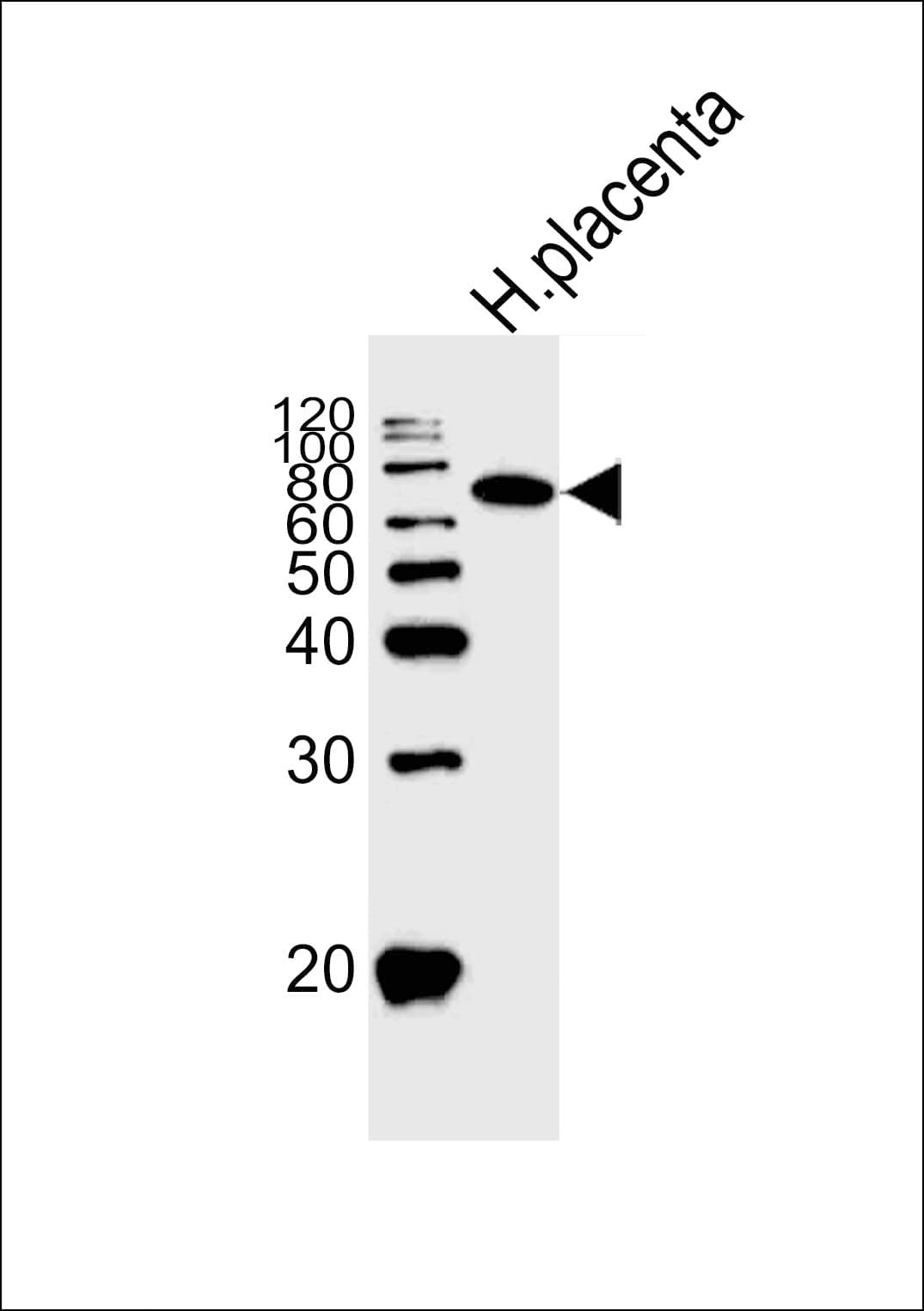 ALPI / Alkaline Phosphatase Antibody (aa274-304)