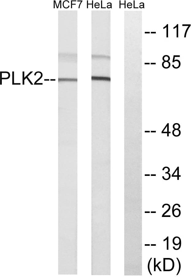 IHC-plus™ SNK / PLK2 Antibody (aa291-340)