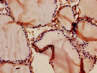 Polyclonal Rabbit anti-Human CCNT1 / Cyclin T1 Antibody (IHC)