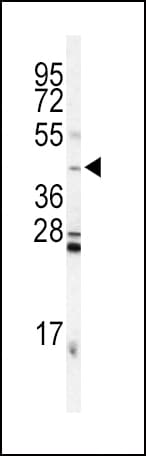Polyclonal Rabbit anti-Human INHA / Inhibin Alpha Antibody (aa79-108, IHC, IF, WB)