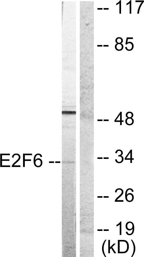 E2F6 Antibody