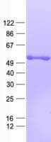 Human CTG-B45d / THAP11 Protein (Recombinant His, N-Terminal)